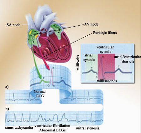 AWT IMAGE